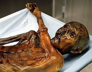 Oetzi the Iceman
